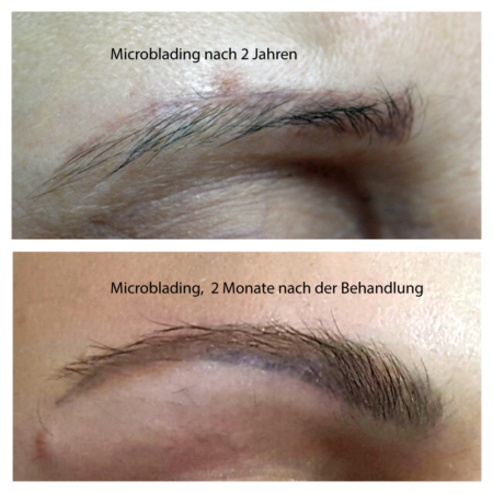 Microblading