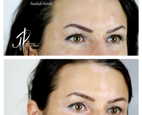 hautpigmentation-camouflage_7_20180116_1896566335 Dermapigmentation