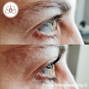 Wimpernlifting